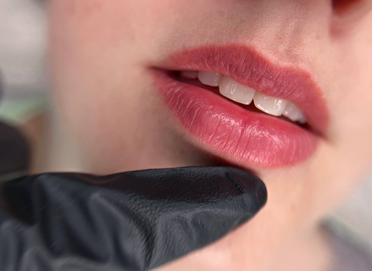 LIPPEN